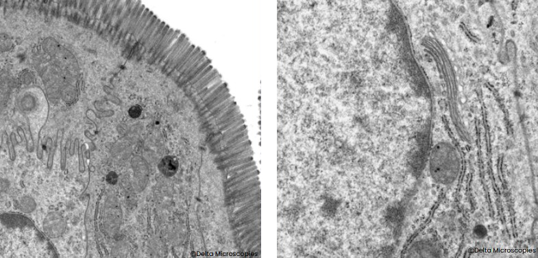Stain 77 Ultra-thin sections - Positive stain